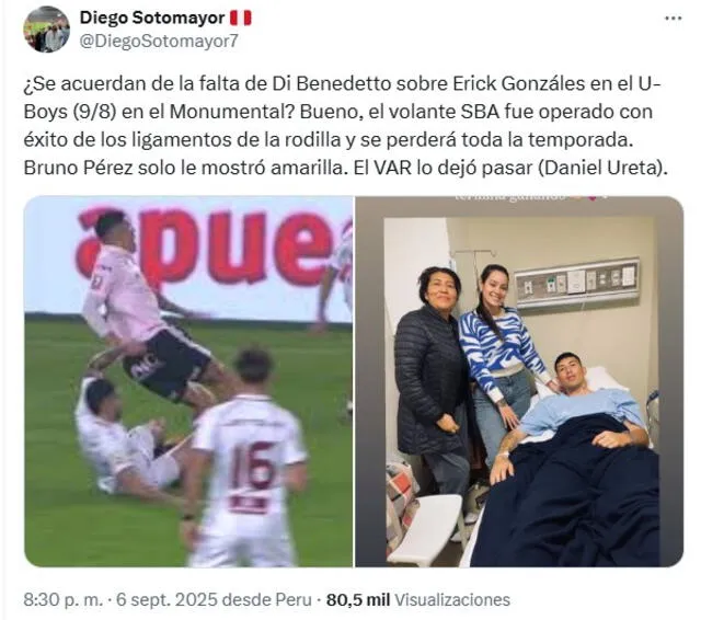 Liga 1
