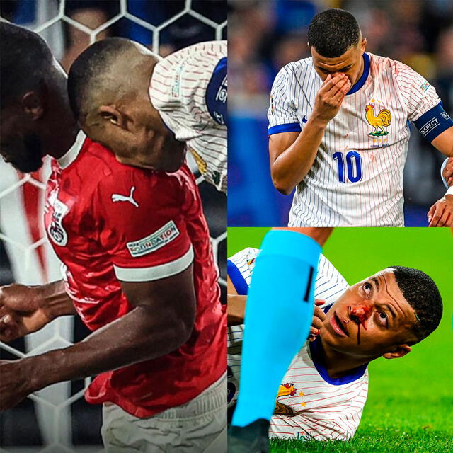 Mbappé salió de la cancha lesionado. / Foto: X.   