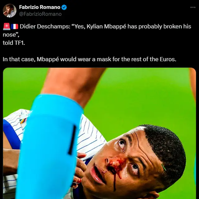 Mbappé podría usar mascara en el resto de la Eurocopa. / Foto: X. 
