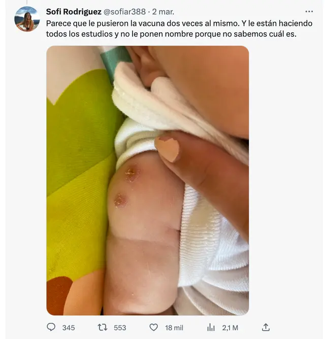 viral viral