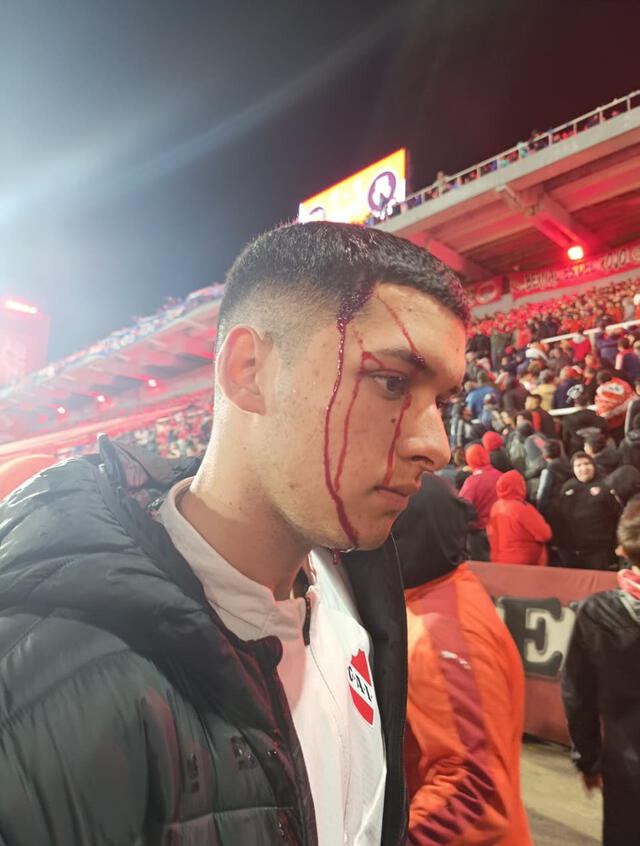 independiente u. de chile