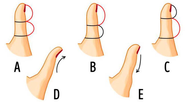 Descubre más sobre ti escogiendo un dedo en este test. Foto: Genial Gurú.   