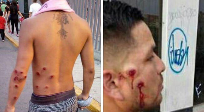 Sport Boys: Policía Nacional cometió terribles abusos contra hinchas en la “Noche Rosada”
