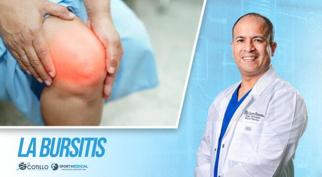 ¿Qué es la bursitis y cómo identificar?, por el Dr. Luis Cotillo