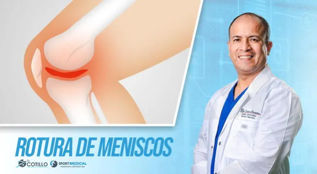¿Cómo saber si te rompiste el menisco?, por el Dr. Cotillo