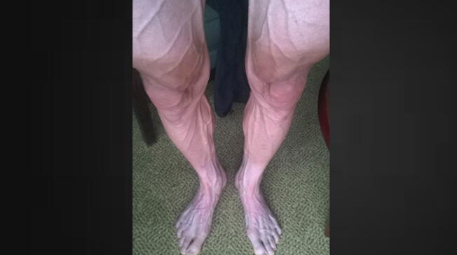 Así quedaron las piernas del polaco Bartosz Huzarski, tras la etapa 18 del Tour de Francia.