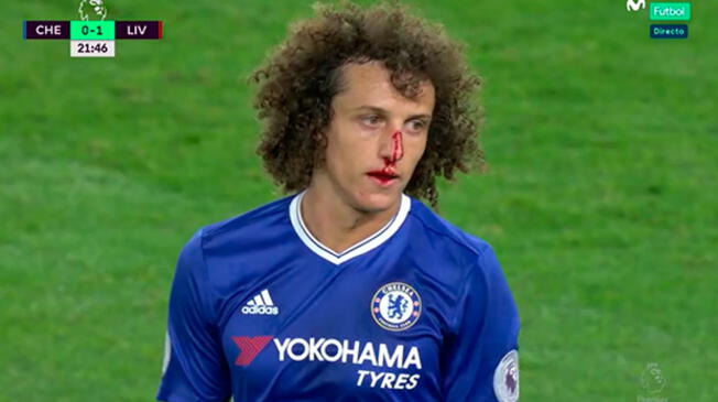 David Luiz con la cara ensangrentada en el Chelsea-Liverpool.