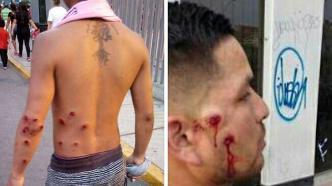Sport Boys: Policía Nacional cometió terribles abusos contra hinchas en la “Noche Rosada”