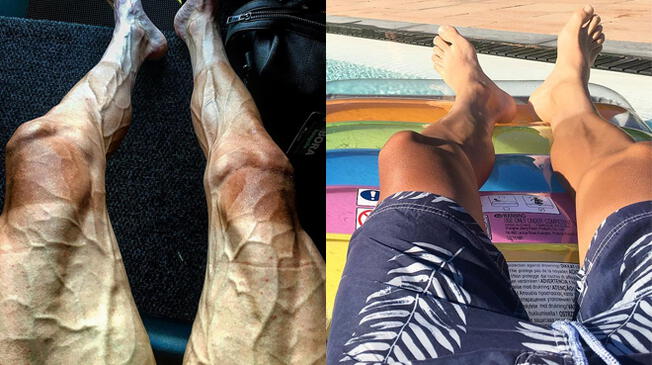 Las piernas del ciclista Pawel Poljanski antes y después del campeonato.