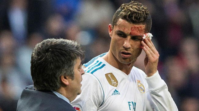 Las fans de Cristiano sufrieron por el corte en el último juego del Real Madrid