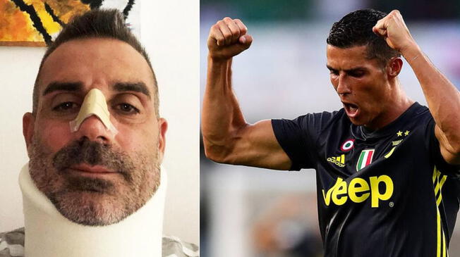 Cristiano Ronaldo se comunicó con el portero del Chievo Verona, Stefano Sorrentino, luego de que resultó malherido tras un choque con él.