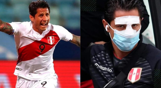 Gianluca Lapadula se protegerá la nariz en el Perú vs Brasil.
