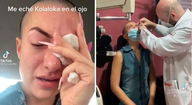 TikTok Influencer confunde kola loka con gotas oculares y se pega el párpado