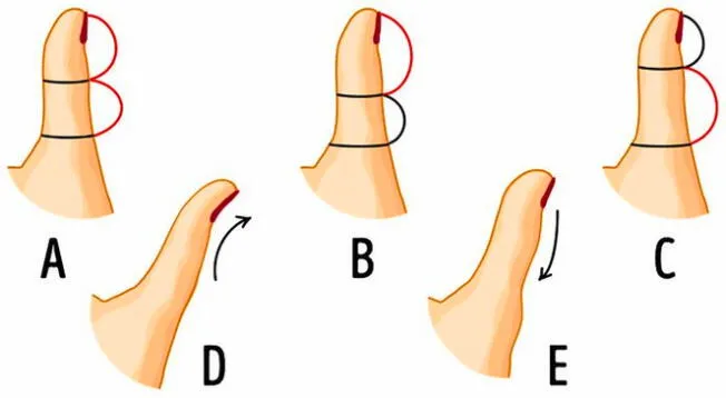 Test viral: ¿Cómo es la forma de tu dedo pulgar? tu respuesta revelará tu verdadero carácter Test viral: ¿Cómo es la forma de tu dedo pulgar? tu respuesta revelará tu verdadero carácter