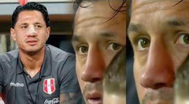 ¿Gianluca Lapadula con la nariz enderezada?