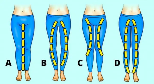 ¿Qué forma tienen tus piernas? Responde este test y conoce más sobre tu personalidad