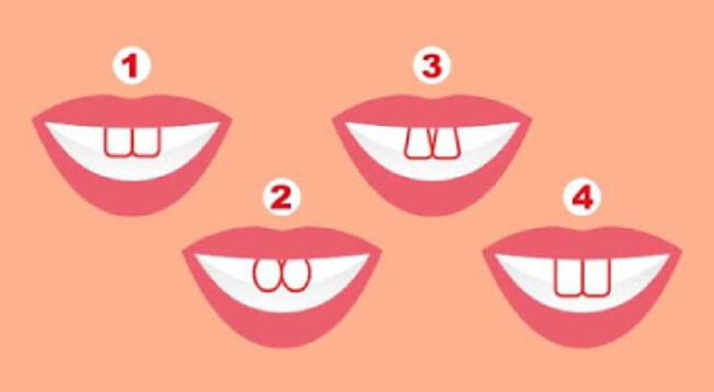 La forma de tus dientes puede decir mucho sobre tu personalidad.