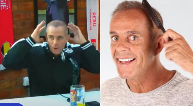 Julinho reapareció con trasplante de cabello y es viral: