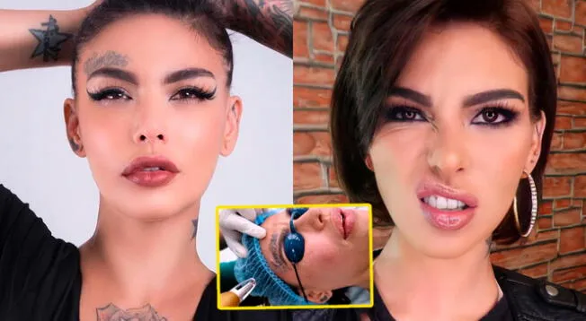 La controversial modelo decidió borrar todos sus tatuajes.