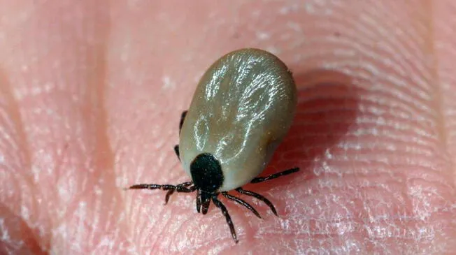 Las garrapatas deben ser eliminadas de inmediato de tu cuerpo, pero no con la mano.
