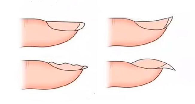 ¿Qué clase de uña tienes?: Este test ayudó al 98% a conocer sus miedos más profundos