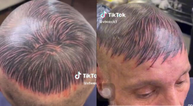 TikTok: Hombre se tatúa cabello para disimular calvicie