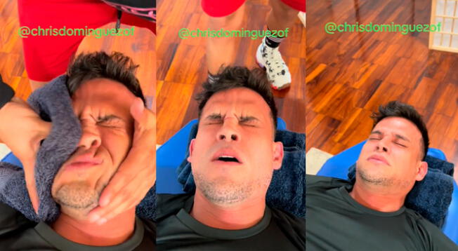 Christian Domínguez se volvió viral en TikTok luego que un quiromasajista le realice un fuerte movimiento en su nariz operada.