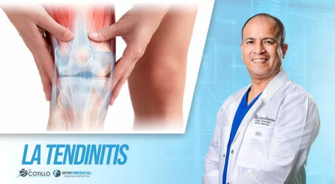 ¿Qué es la tendinitis y cómo se puede detectar?, por el Dr. Luis Cotillo ¿Qué es la tendinitis y cómo se puede detectar?, por el Dr. Luis Cotillo