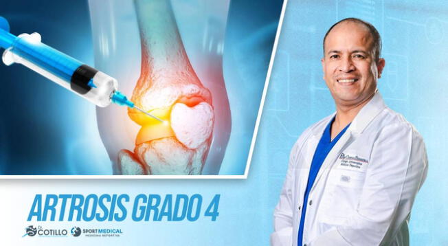 Es falso que el ácido hialurónico sea bueno para la artrosis grado 4 Es falso que el ácido hialurónico sea bueno para la artrosis grado 4