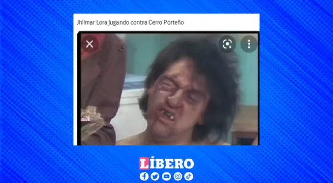 Jhilmar Lora, lamentablemente, perdió un diente tras falta de jugador de Cerro. Jhilmar Lora, lamentablemente, perdió un diente tras falta de jugador de Cerro.