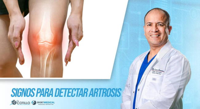 ¿Cuáles son los signos para detectar artrosis? ¿Cuáles son los signos para detectar artrosis?