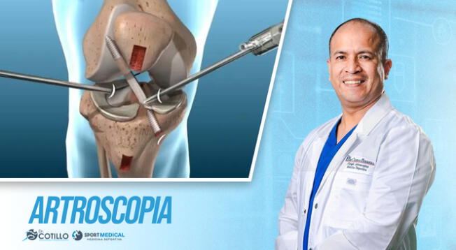 Lo que nunca debe pasar después de una artroscopia, por el Dr. Luis Cotillo Lo que nunca debe pasar después de una artroscopia, por el Dr. Luis Cotillo