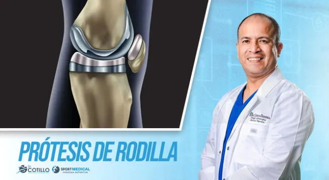 ¿Cuándo se recomienda una prótesis total de rodilla? ¿Cuándo se recomienda una prótesis total de rodilla?