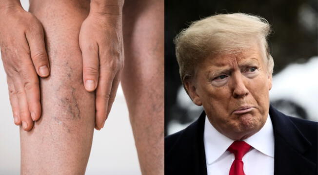 Todo sobre el diagnóstico médico del presidente de Estados Unidos.