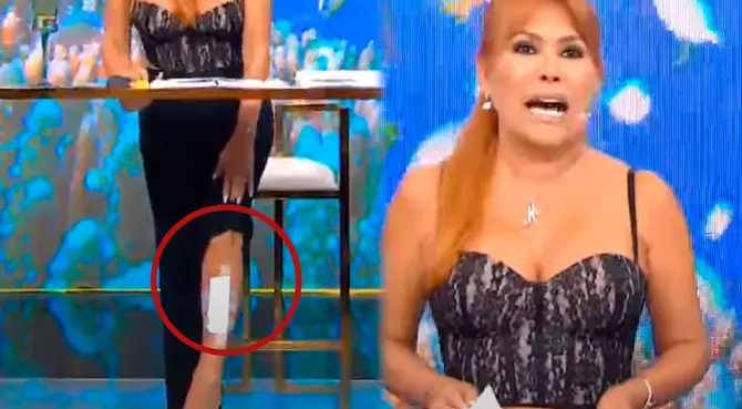 Magaly Medina contó que sufrió un accidente. Magaly Medina contó que sufrió un accidente.
