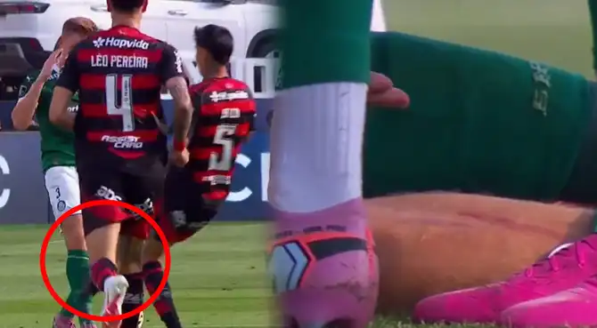 Erick Pulgar no fue expulsado por fuerte entrada a Fuchs. Erick Pulgar no fue expulsado por fuerte entrada a Fuchs.