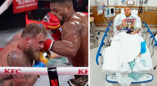 Así quedó el rostro de Jake Paul tras su pelea contra Anthony Joshua.