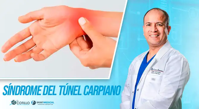 Síndrome del túnel carpiano